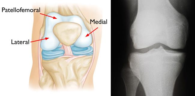 Knee Joint